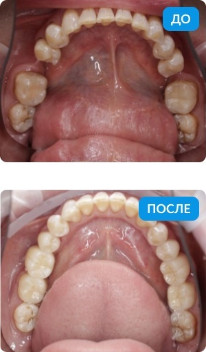 Быстро, эстетично, на долгие годы